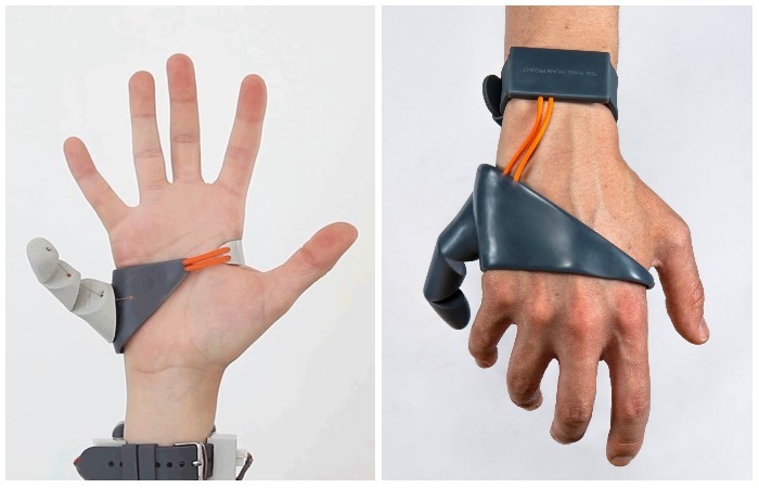 The Sixth Finger: Science Fiction or Useful Invention?